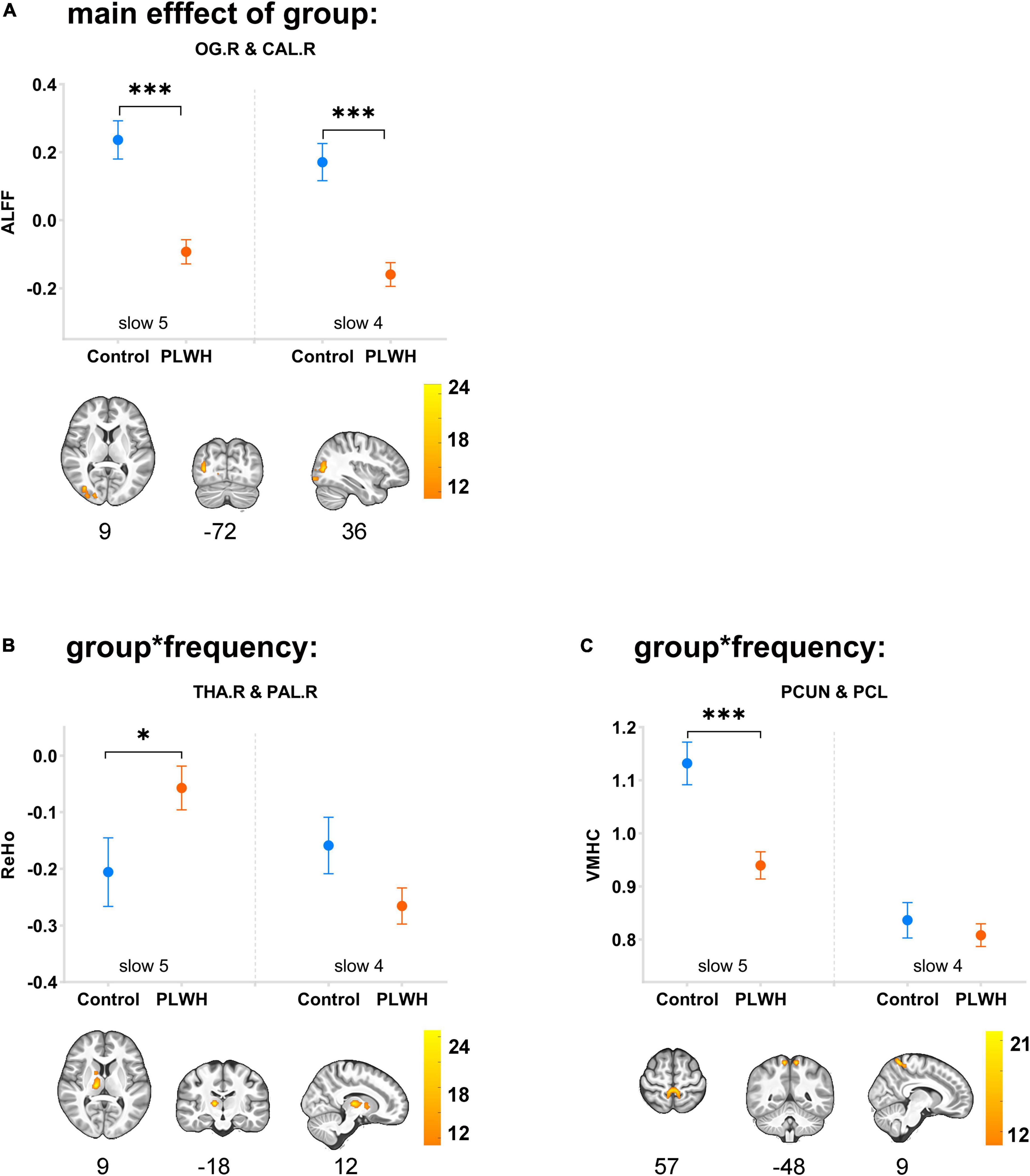 Frequency-dependent functional alterations in people living with HIV with early stage of HIV-associated neurocognitive disorder